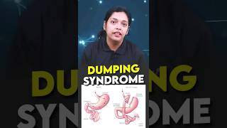 Dumping Syndrome Everything You Need To Know shorts sciencefacts dumpingsyndrome cds tap2crack [upl. by Ahsemrac886]