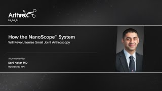 How the NanoScope™ System Will Revolutionize Small Joint Arthroscopy [upl. by Ervin165]