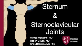 Sternum and Sternoclavicular Joints  Wilfred Manzano MD [upl. by Teirtza]