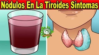 Nódulos En La Tiroides Síntomas y Tratamiento Natural Prueba Este Jugo y Bébelo De Esta Forma [upl. by Roselani]