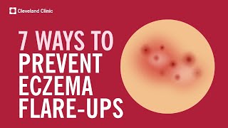 7 Ways to Prevent Eczema FlareUps [upl. by Koren]