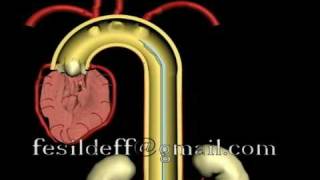 IABP Intraaortic Ballon Pump [upl. by Ytsanyd]