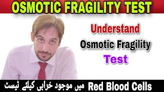 Osmotic fragility test  Osmotic Fragility Test Procedure  Osmotic Fragility Test Practical [upl. by Yahsal]