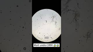 Sparkling water magnified 400 times is so cool underthemicroscope microscope shorts [upl. by Wiedmann529]