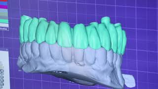 Lab technology at its finest  Dental Med Austria Clinic  I smile with Dental Med Austria [upl. by Ailito]