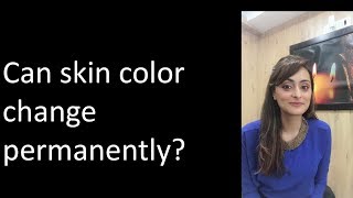 Can your skin tone change from dusky to fair  Dr Aanchal [upl. by Netsirk983]