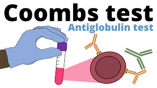 Coombs Test antiglobulin test [upl. by Wheaton]