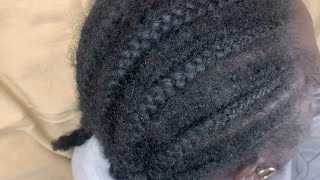 Scalp Scratching to help you relax and sleep between braids  ASMR asmrscalpscratching asmrsleep [upl. by Llebyram]