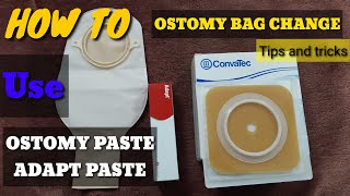 How To Change Ostomy Bag  How To Use Adapt Past  How To Use Ostomy Paste in hindi urdu [upl. by Thessa]