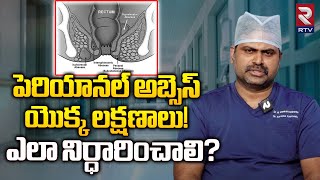 పెరియానల్ అబ్సెస్ యొక్క లక్షణాలు  PERIANAL ABSCESS Treatment Explianed By DrVenkateshwarlu  RTV [upl. by Maisey]