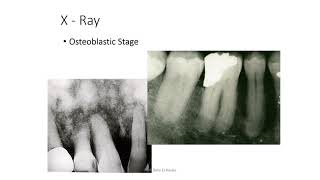 Bone Diseases 2 [upl. by Friedrich801]