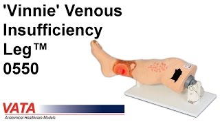 0550  Vinnie Venous Insufficiency Leg™ [upl. by Ahsinauq]