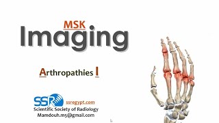 05 Joint disease arthropathy I TEC Prof Mamdouh Mahfouz [upl. by Yelkcub]