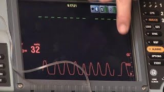 Waveform Capnography [upl. by Atalante]