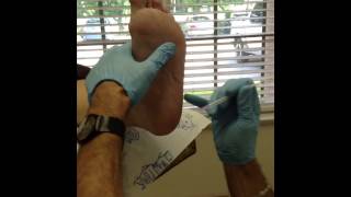 Injection for heel spur plantar fasciitis [upl. by Earb]