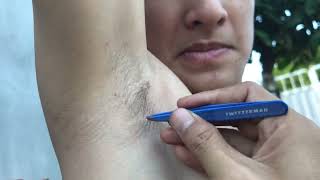 ARMPIT HAIR REMOVAL for mr Cao Đại Doãn ASMR [upl. by Annabelle831]