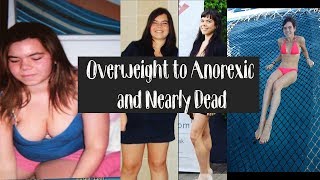 My Eating Disorder Journey Overweight to Anorexic [upl. by Agnella871]