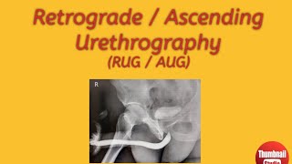 Retrograde  Ascending Urethrography Procedures preparation guide [upl. by Ahsimak279]