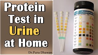 Urine Protein Test [upl. by Nnoved]