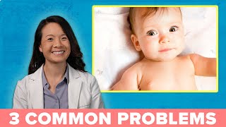 3 Common Eye Problems in Babies [upl. by Bethina891]