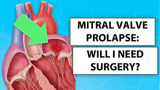 Mitral Valve Prolapse Will I Need Heart Surgery [upl. by Rise]