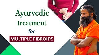 Ayurvedic Treatment for Multiple Fibroids  Swami Ramdev [upl. by Sinnaiy]