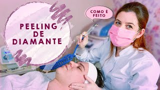 Peeling de Diamante  Benefícios como é feito e aparelho [upl. by Alicul]