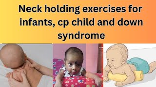 NECK CONTROL EXERCISES FOR CEREBRAL PALSY KIDS INFANTS amp DOWN SYNDROME [upl. by Konstanze876]