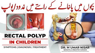 Blood In Stool Melena Vs Hematochezia [upl. by Currey]