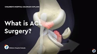 What is ACL Surgery [upl. by Eekram]