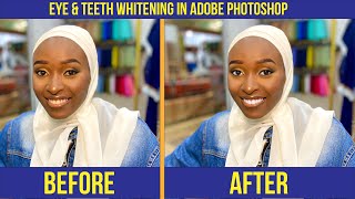 EYE amp TEETH WHITENIG AND SKIN SMOOTHENING IN ADOBE photoshop [upl. by William678]