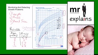 mr i explains Monitoring and detecting growth problems in infants using Growth Charts [upl. by Oterol]