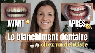 BLANCHIMENT DENTAIRE chez le dentiste prix durée sensibilité [upl. by Nivrehs]