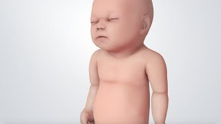 Infant Distress Warning Signs Grunting Baby Sound [upl. by Elocaj]