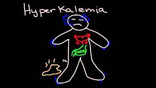 Hyperkalemia [upl. by Lazar770]