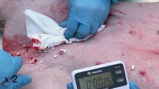 Bioinspired Hemostatic Strategy via Pulse Ejections for Severe Bleeding Wounds Movie 9 [upl. by Spanjian]