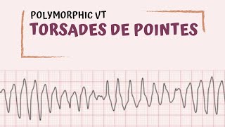 Torsades de Pointes [upl. by Alejna]