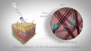 In vitro study of RRS HA injectable mesotherapy  Video abstract 95108 [upl. by Eneiluj]