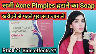 Clinlook soap  Best pimple soap  खिल मुंहासों का साबुन  पिंपल का साबुन  क्लिनलुक साबुन [upl. by Celestyna]