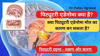 What is Pituitary Gland  Pituitary Tumour  Tumour  Brain Tumour Symptoms  Brain Tumour [upl. by Nelad]