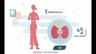 Know about Primary Aldosteronism PA [upl. by Gilli]