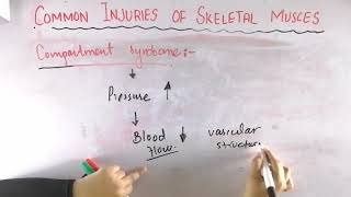 Compartment syndrome  Common injuries of skeletal muscle  Biomechanics of skeletal muscle [upl. by Aerb]