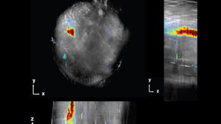 Webinar 062016 Molecular Imaging of Cancer Biomarkers Using MSOT [upl. by Imeaj]