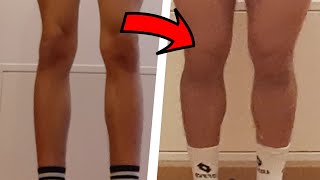 How I TRANSFORMED my CALVES bad genetics [upl. by Ellecrag]