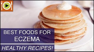 Best Foods for Eczema  Healthy Recipes [upl. by Bertsche]