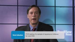 Improving Outcomes in Patients With Uveitis [upl. by Mundy]