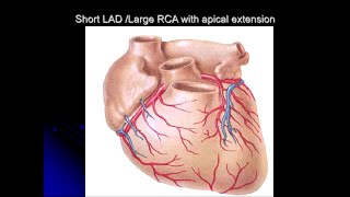 CORONARY ANGIOGRAPHIC VIEWS AND SYNTAX SCORE  BS Nguyễn Thanh Nhựt [upl. by Koy]