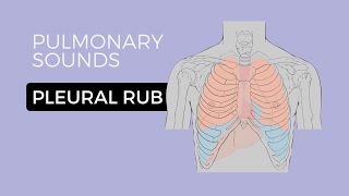 05  Lung Sounds  Pleural friction rub 🎧 [upl. by Notlrac44]