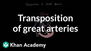 Transposition of the Great Arteries [upl. by Ty]