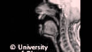 MRI voiced alveolar lateralapproximant [upl. by Ravid]